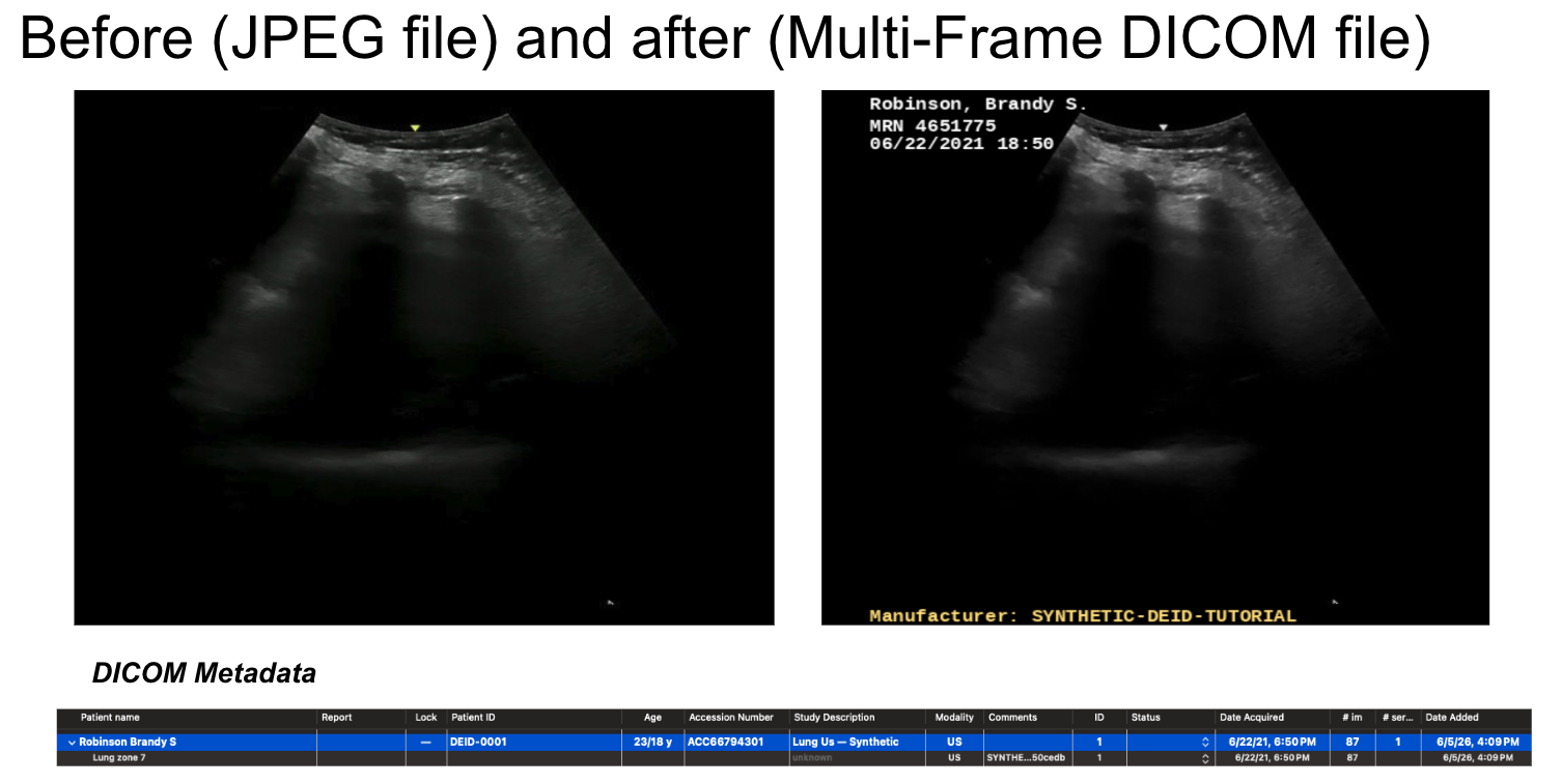 Synthetic ultrasound DICOM containing generated PHI in image overlays and metadata.